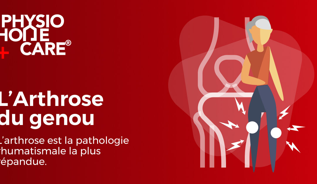 L’arthrose de genou : la comprendre et mieux la soigner ?