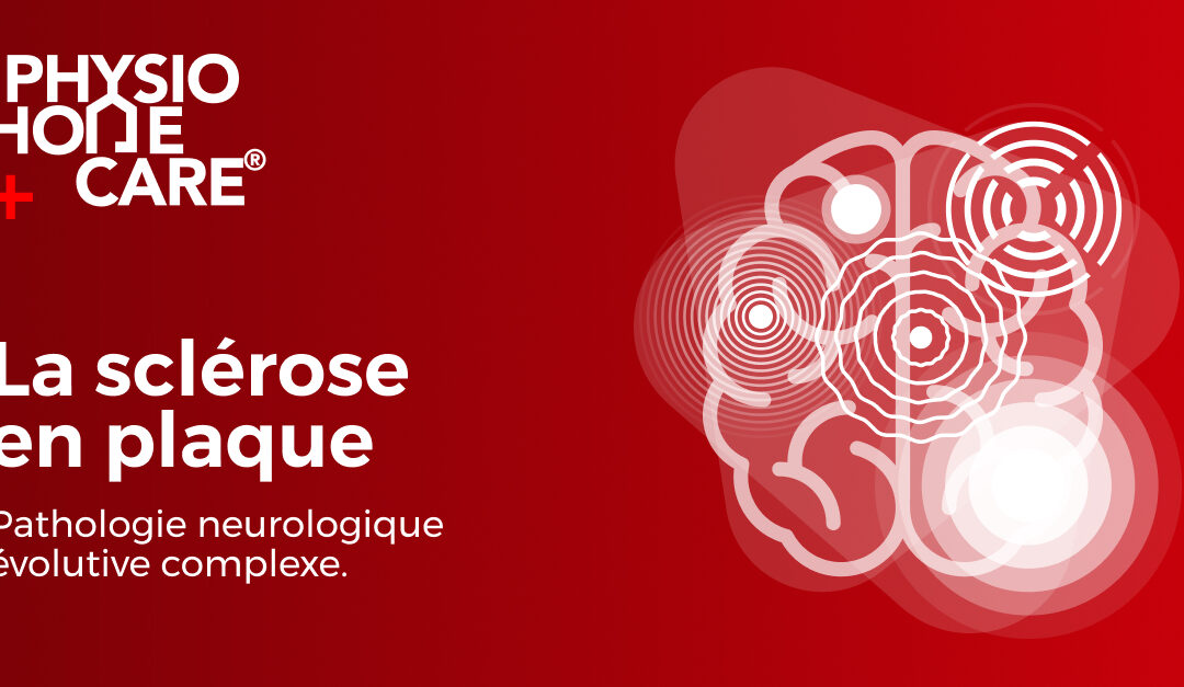 La sclérose en plaque : pathologie neurologique évolutive complexe