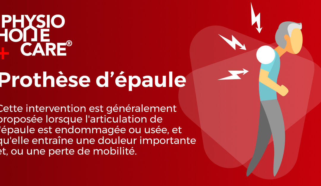 Prothèse d’épaule : méthodes opératoires et rééducation