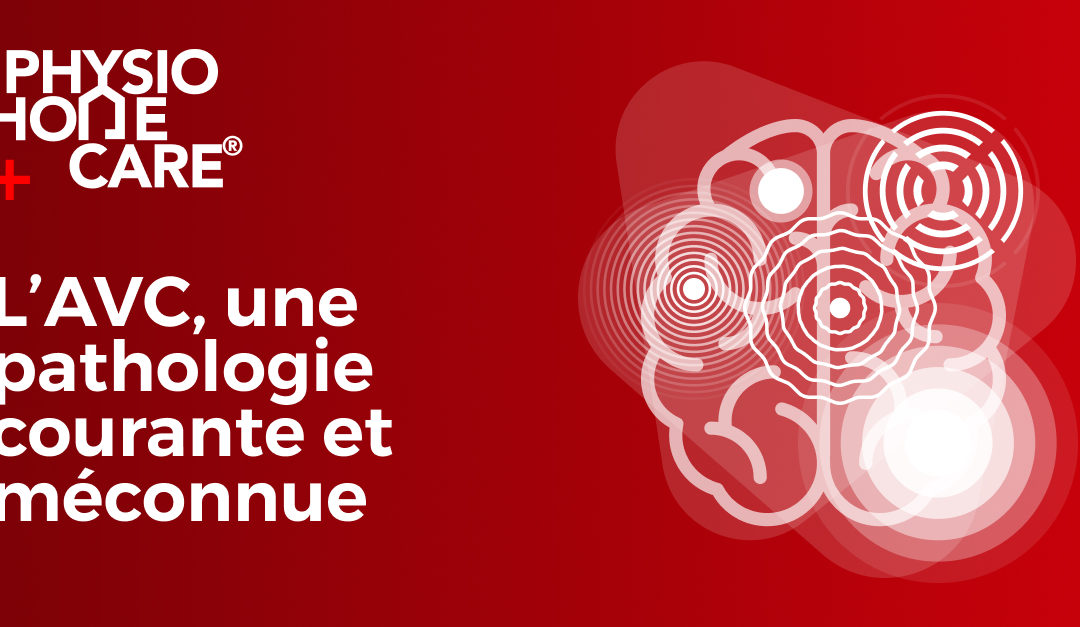 L’AVC, une pathologie courante et méconnue